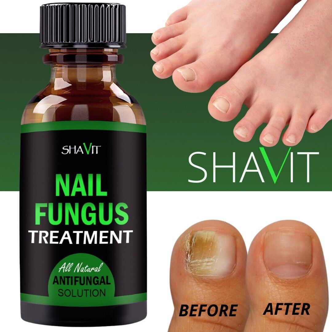 Anti-Fungal Treatment Extra Strength