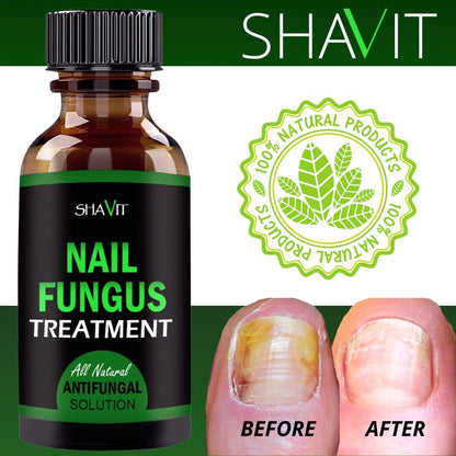 Anti-Fungal Treatment Extra Strength