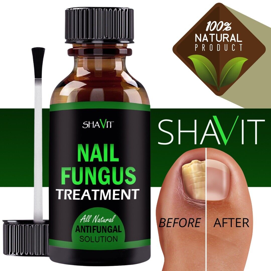 Anti-Fungal Treatment Extra Strength