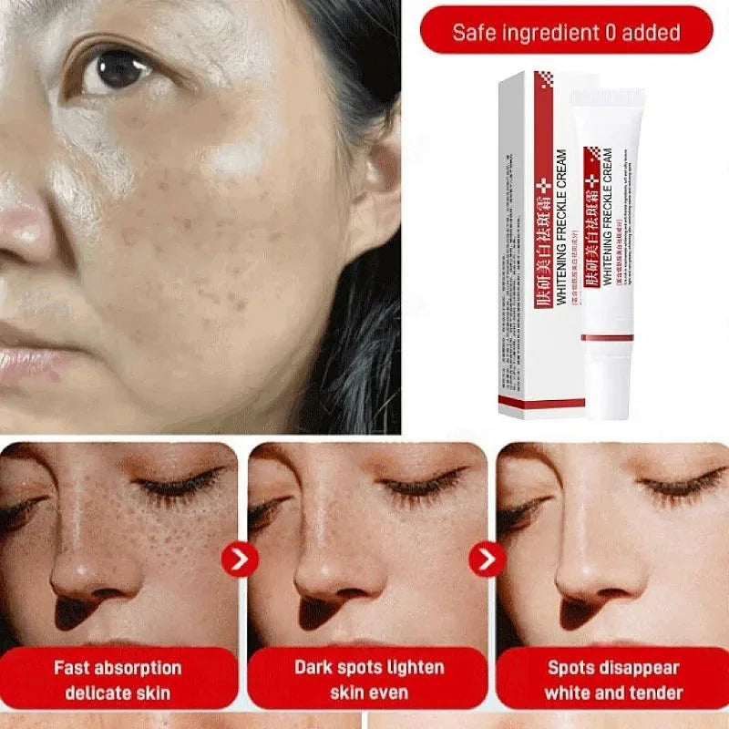 Face Melasma Cream