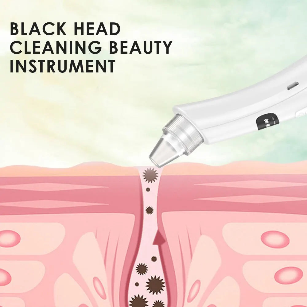 Face Cleansing Machine for Blackhead Removal