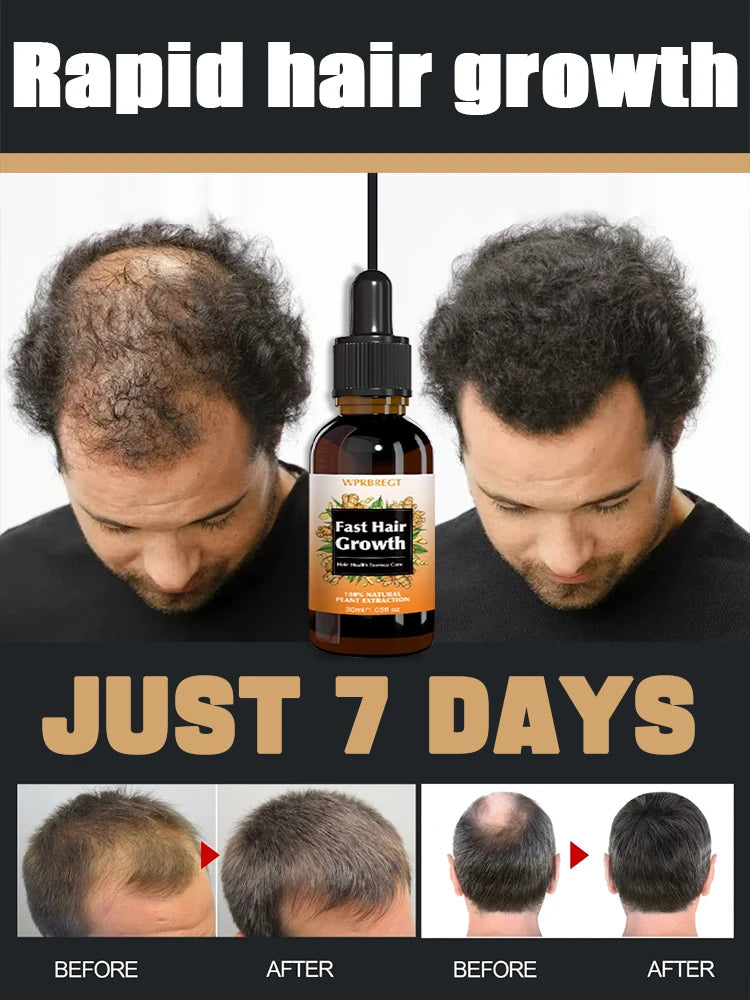 Hair Growth Solution for Baldness Treatment