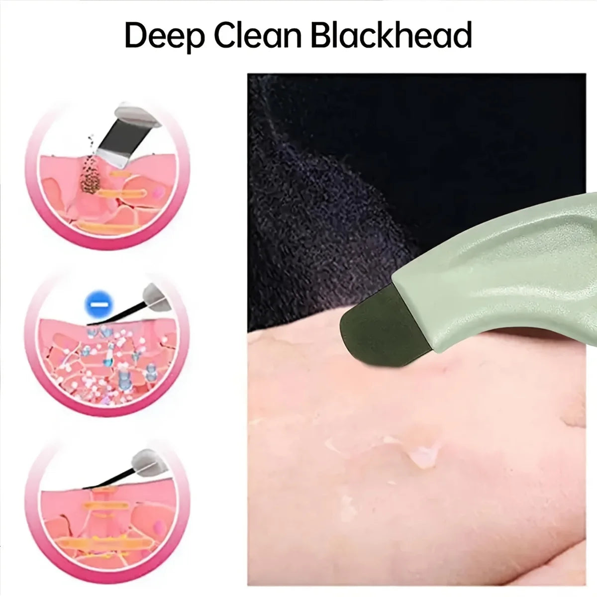 Facial Blackhead Removal &amp; Acne Cleansing Handheld Beauty Tool