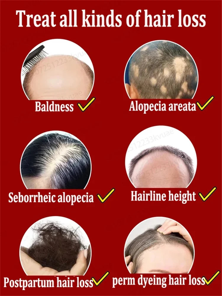 Hair Growth Solution for Baldness Treatment