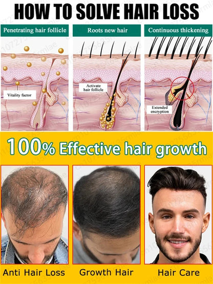 Hair Growth Solution for Baldness Treatment