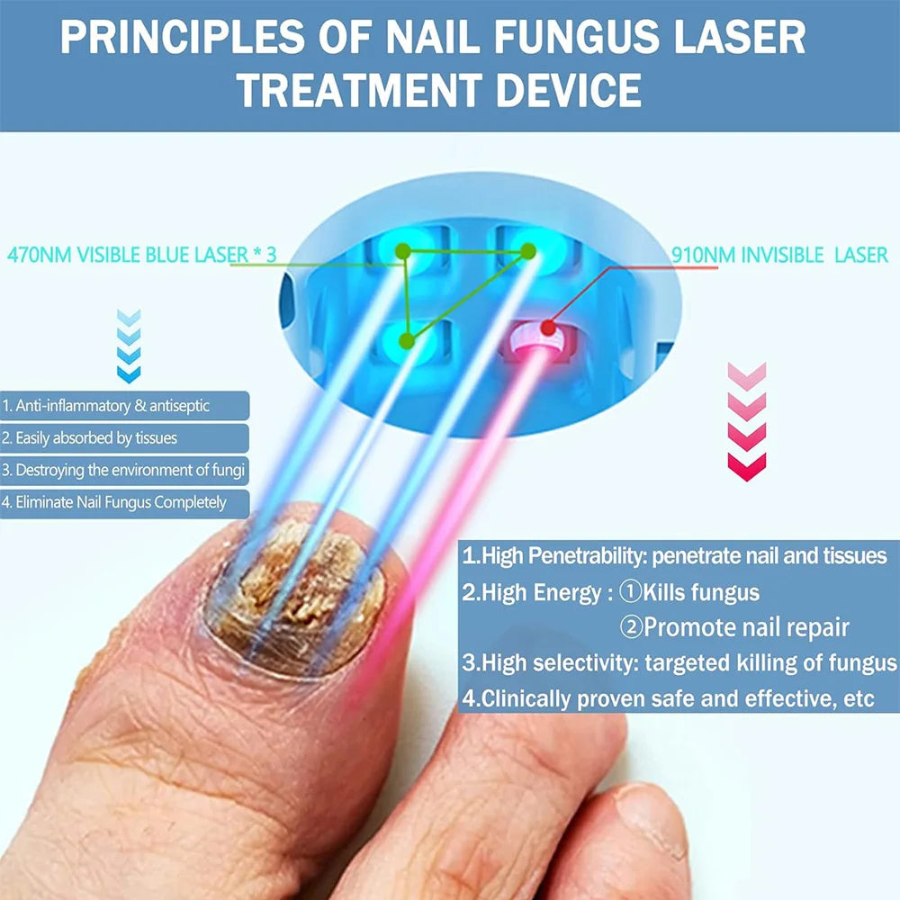 LED Laser Nail Fungus Treatment Device