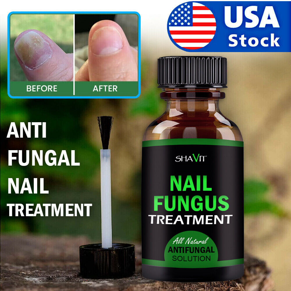 Anti-Fungal Treatment Extra Strength