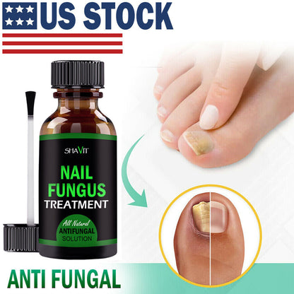 Anti-Fungal Treatment Extra Strength