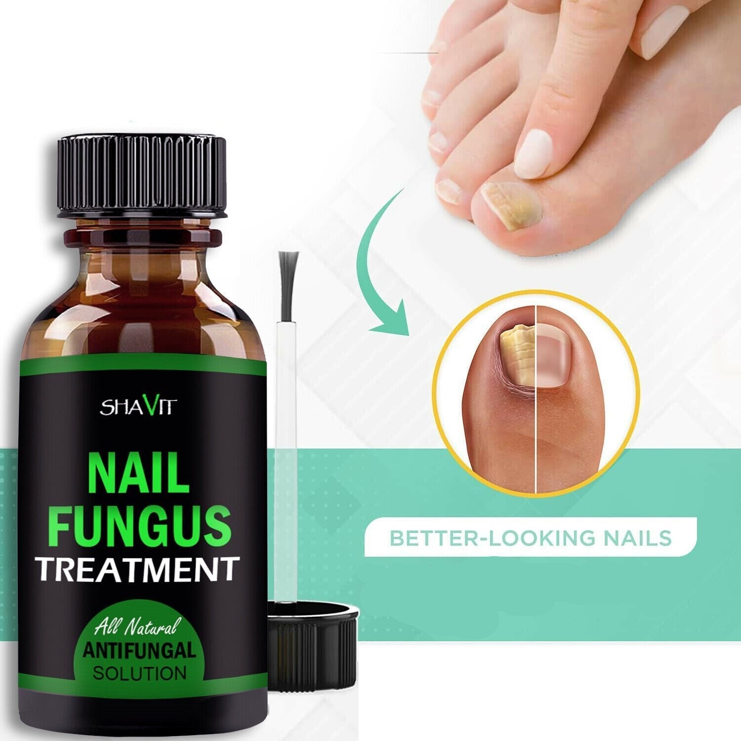 Anti-Fungal Treatment Extra Strength